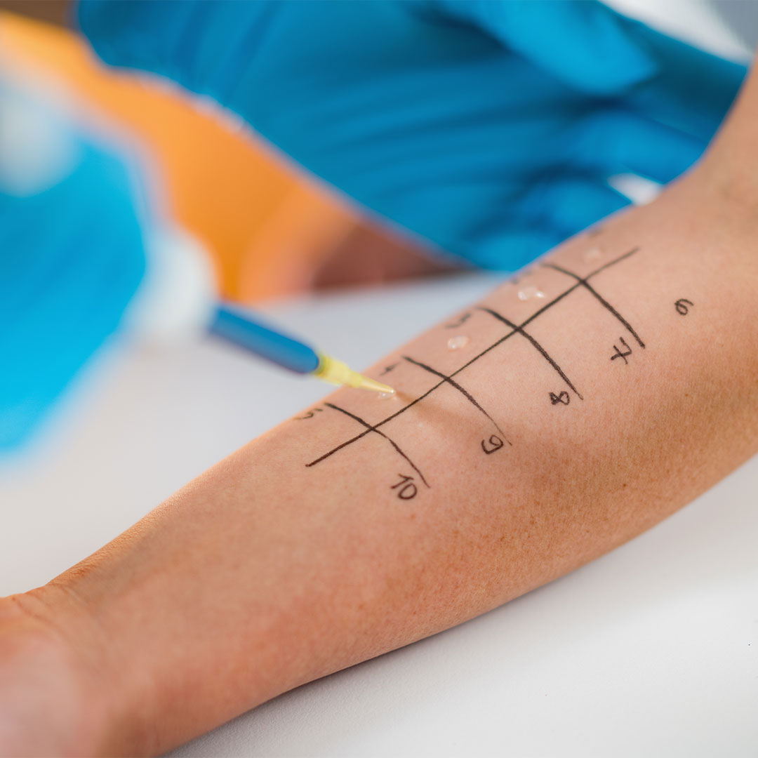 The image features a tattoo on a person s arm with a blue line indicating the progression of the tattoo design, and there is a medical professional in the background wearing gloves and a face mask, suggesting a clinical setting.